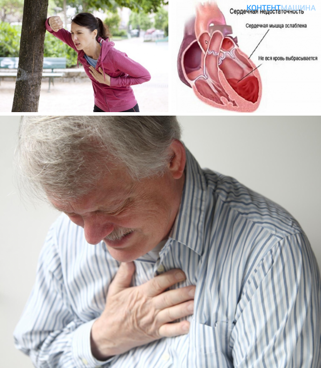 Кашель при болезни сердца: взаимосвязь, симптомы, причины, лечение