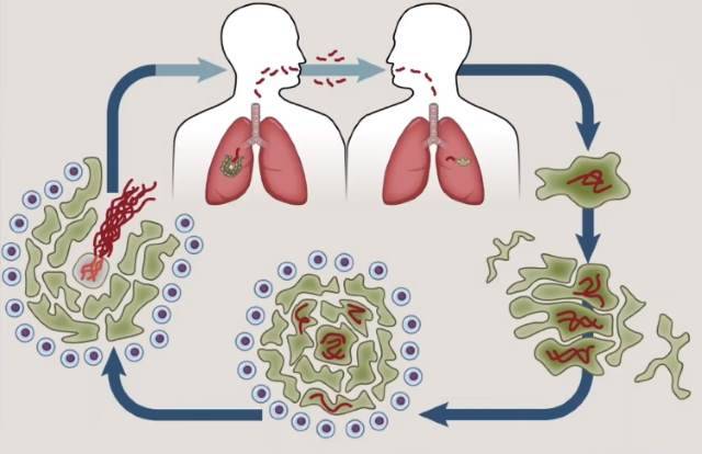 Как передается туберкулез легких от человека к человеку и риски заражения