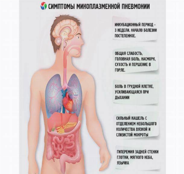 Инкубационный период у различных видов пневмоний