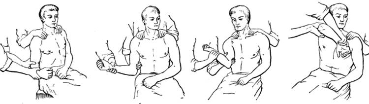 Вывих плеча: симптомы, первая помощь, лечение и реабилитация