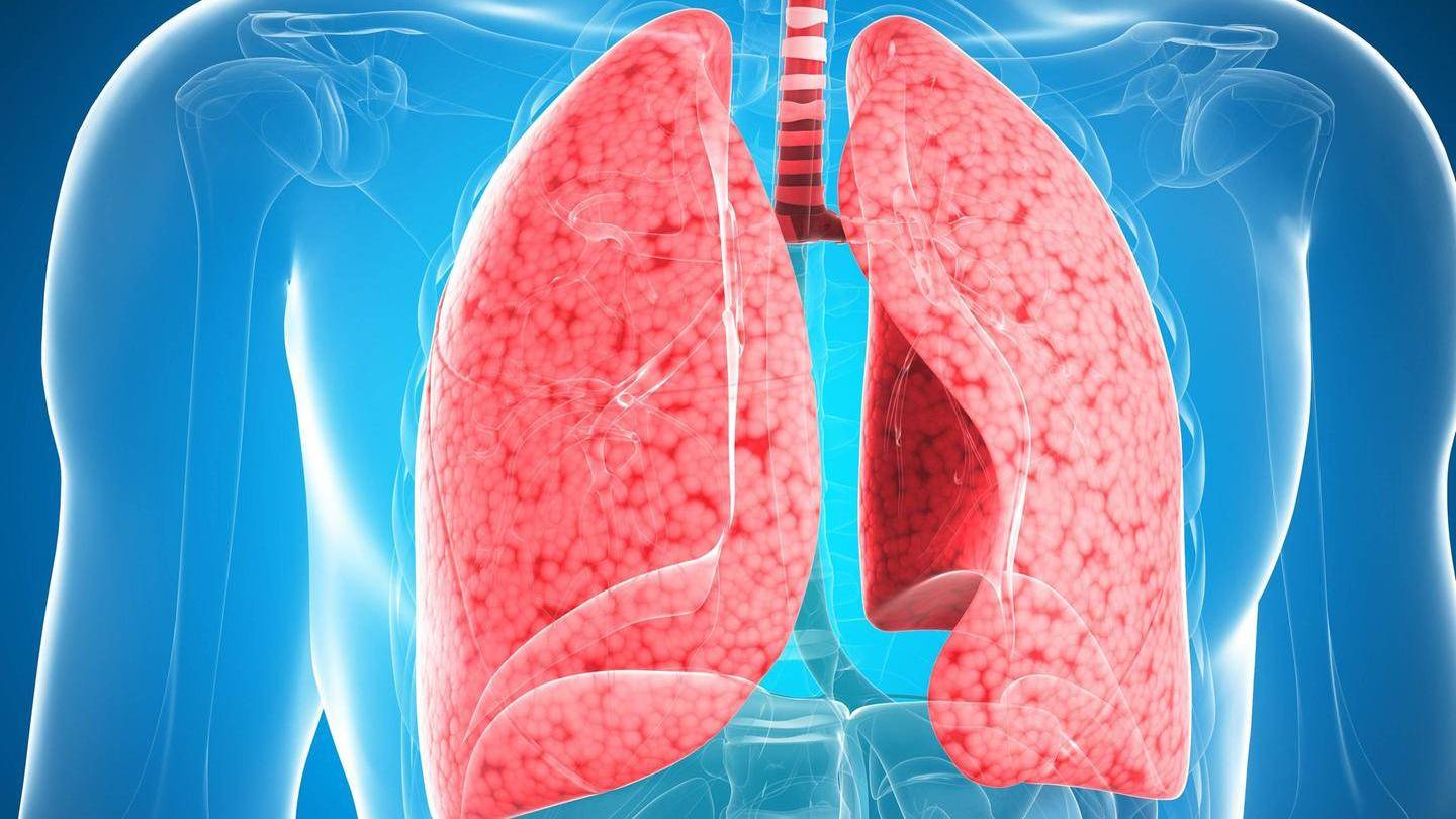 Инфекционная пневмония легких – симптомы и способы лечения