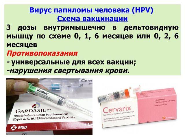 Прививка от впч: виды вакцин, схема введения, побочные эффекты