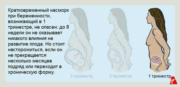 Ангина при беременности в первом триместре