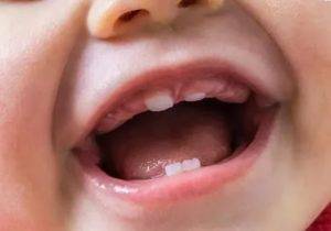 Бывает ли кашель и сопли при прорезывании зубов