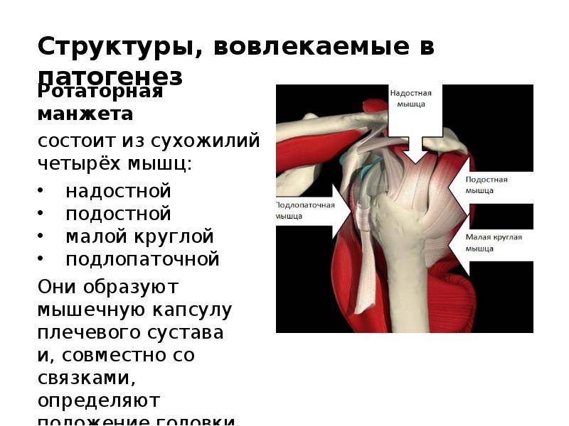 Дегенеративное изменения сухожилия надостной мышцы плеча