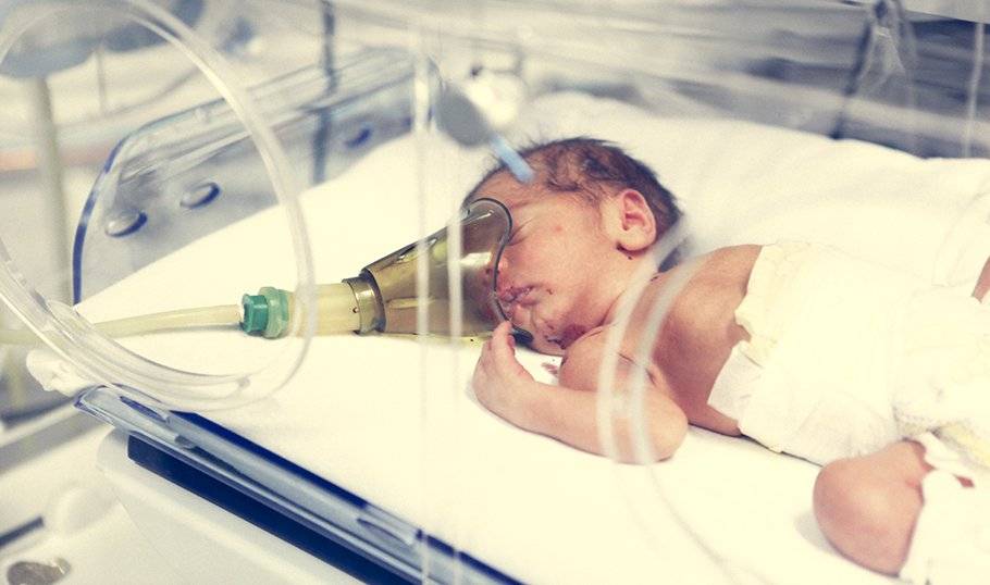 Врожденная пневмония у новорожденных и у недоношенных детей: внутриутробная, двусторонняя, аспирационная, воспаление легких у грудного ребенка после кесарево, причины и последствия у грудничка