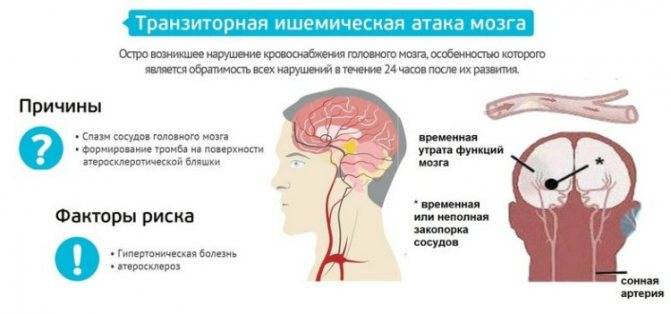 Причины и лечение спазмов сосудов головного мозга