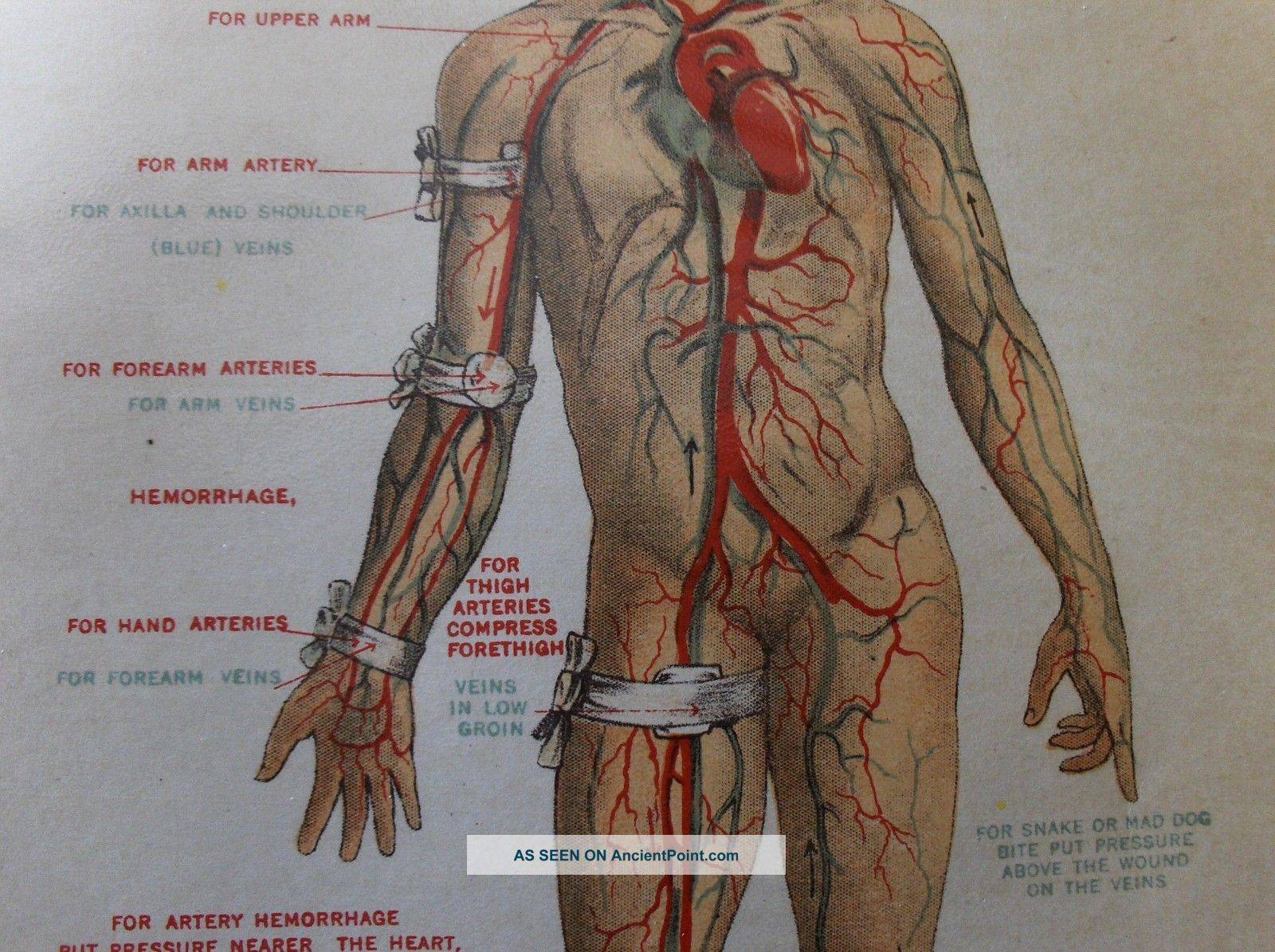 Тромбоз подключичной артерии: анатомия, патофизиология, причины, лечение