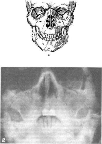 Перелом челюсти: причины, виды и методы лечения