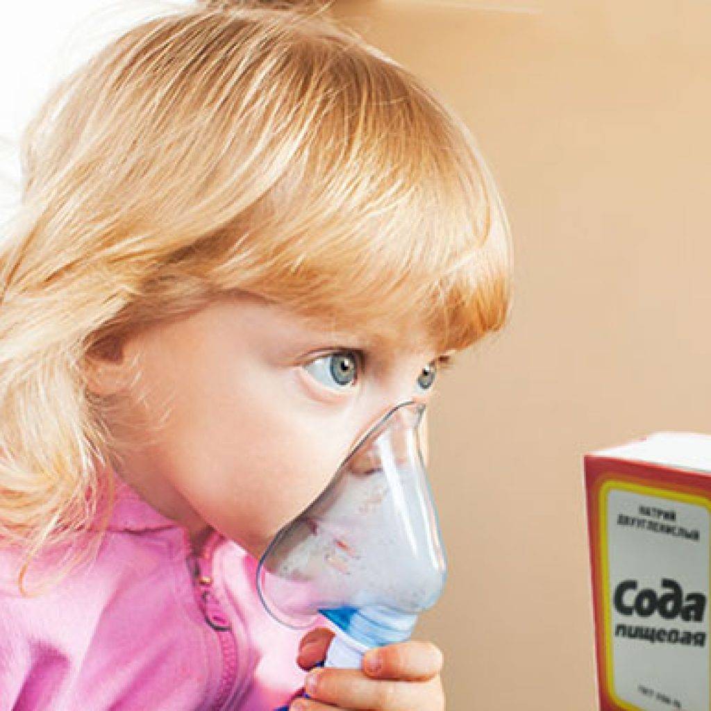 Как сделать ингаляцию в домашних условиях ребенку и взрослому от кашля и насморка