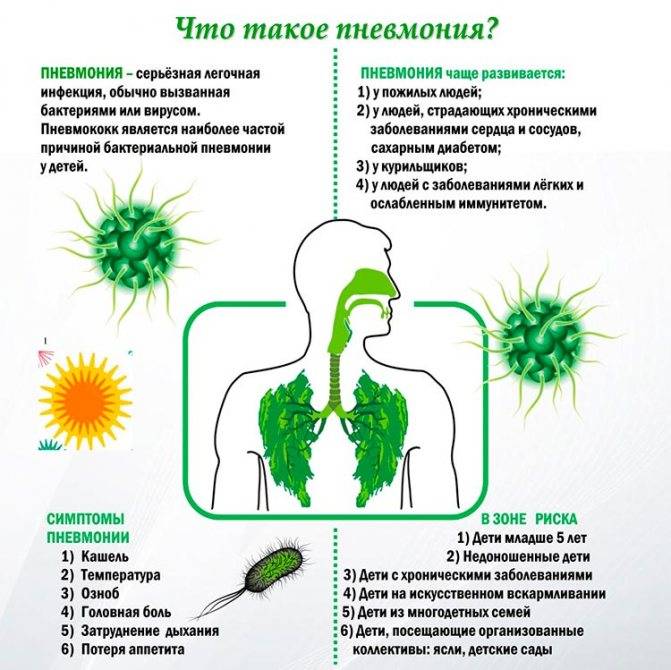 Вирусная пневмония: лечение и симптомы у детей и взрослых, как отличить от бактериальной, признаки, как передается, инкубационный период