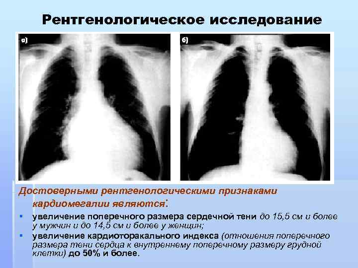 Профилактика, лечение кардиомегалии в новосибирске — причины, диагностика, симптомы — medcentr.online