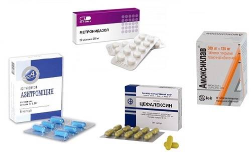 Препараты при микоплазмозе: группы лекарств для эффективного лечения