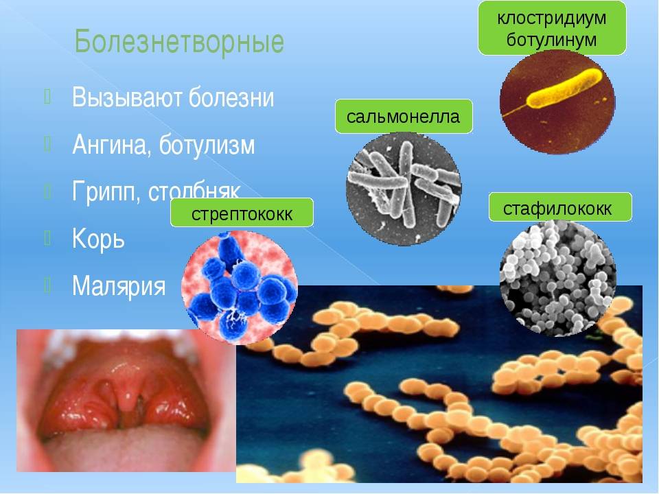 Бактерии вызывающие ангину – микробы в горле: грибок, стрептококк
