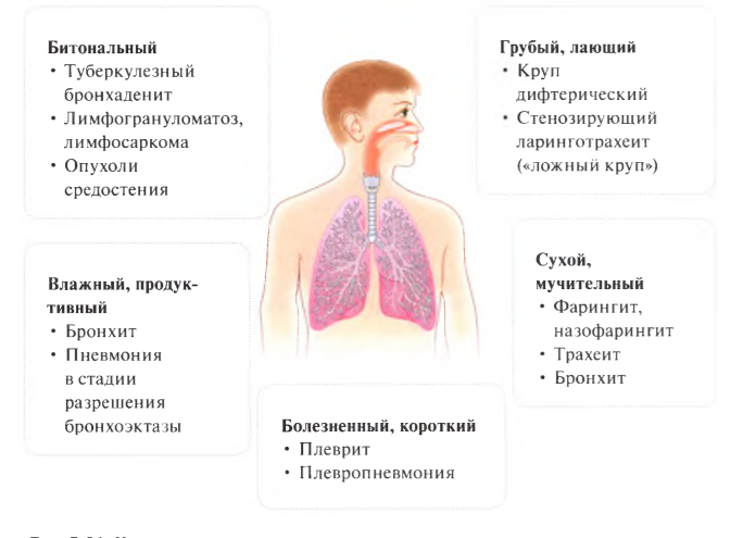 Пневмония и воспаление легких: одно и то же или различные патологии?