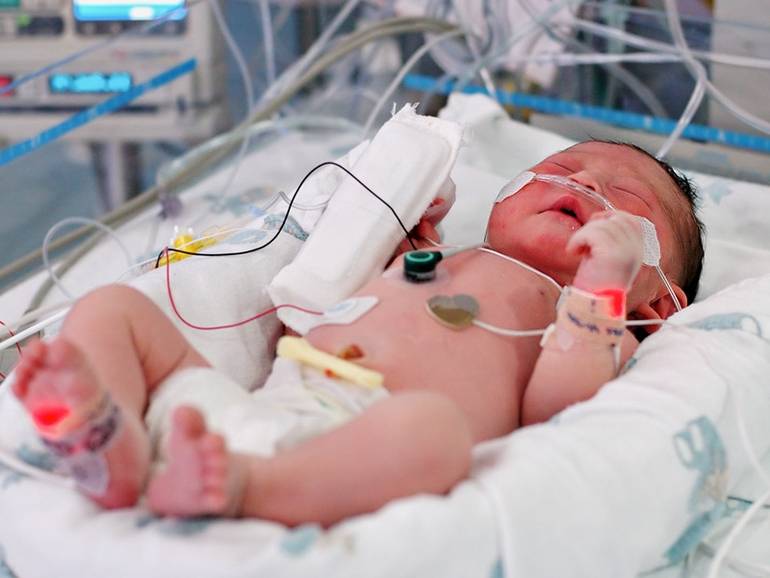 Причины, лечение и последствия пневмонии у новорожденных