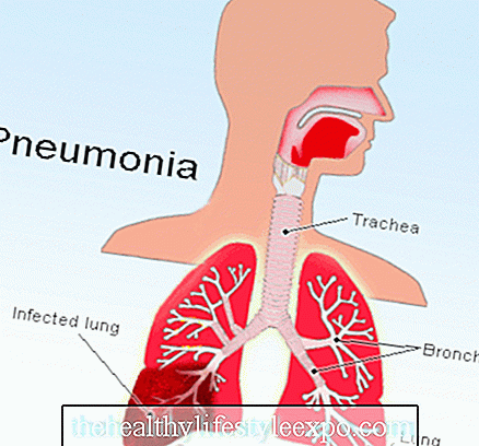 Особенности параканкрозной пневмонии