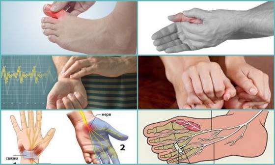 Парестезия: причины, симптомы, как лечить парестезии нижних конечностей, пальцев рук, кожи головы и языка