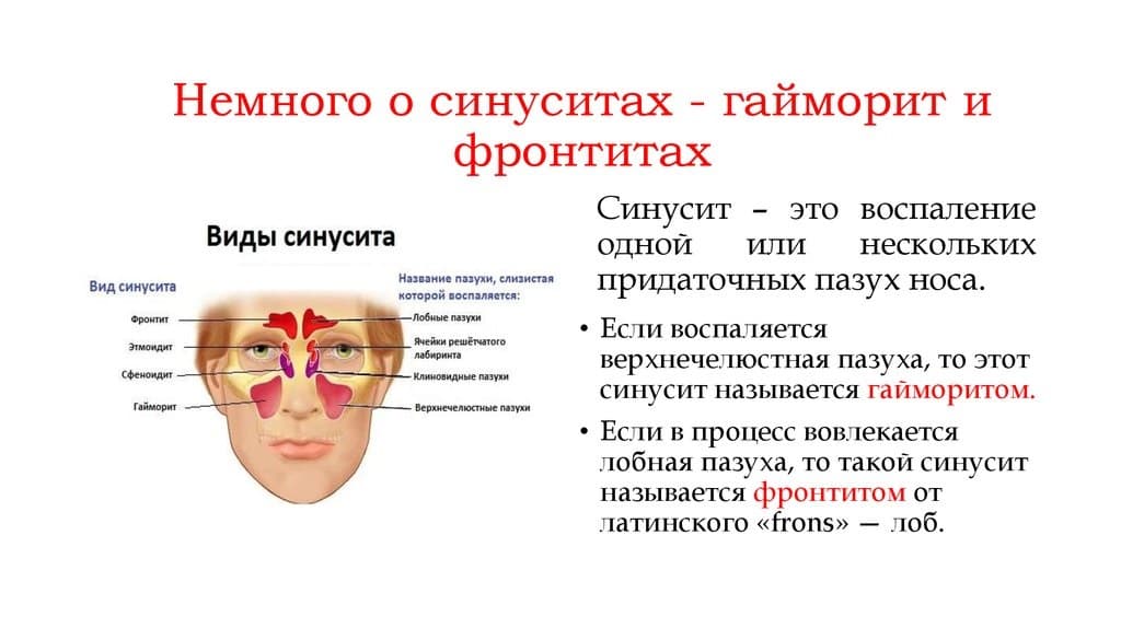 Как определить гайморит: эффективные методы диагностики - горлонос.ру