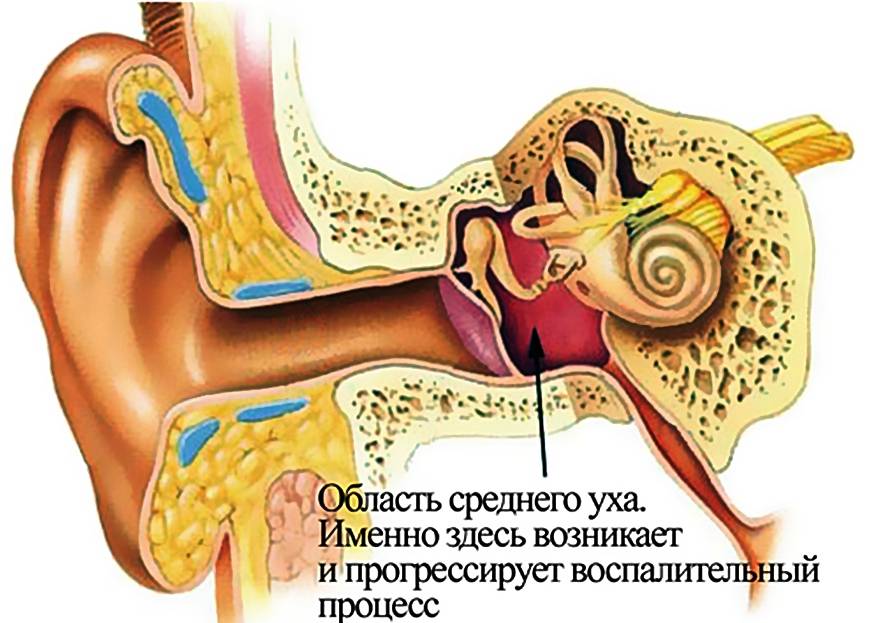 Чем лечить наружный отит уха у взрослых - лечим сами