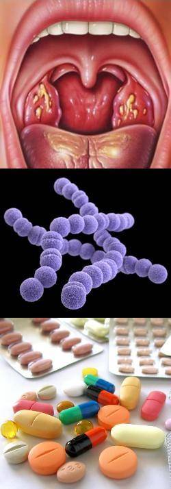 Бактериальная инфекция: бактериолог о формах, отличиях от вирусной, симптоматике, диагностике и лечении