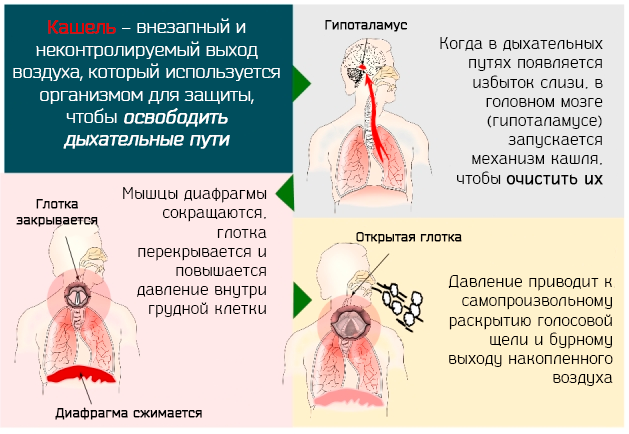 Боль в груди при кашле: причины. кашель и боли. лечение