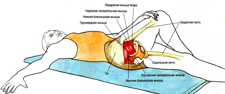 Лечение грушевидной мышцы: методы терапии и профилактические рекомендации