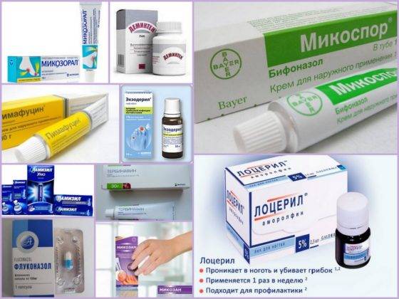 Мазь от грибка: список лучших недорогих средств для лечения микоза