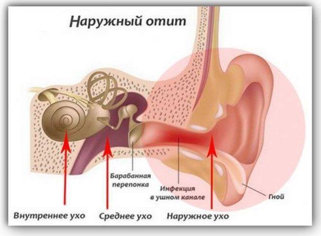 Как лечить, если болит ухо, в домашних условиях: лечение, чем вылечить боль
