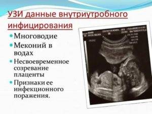 Внутриутробные инфекции у новорожденных, плода при беременности. причины, последствия, что это такое, анализ