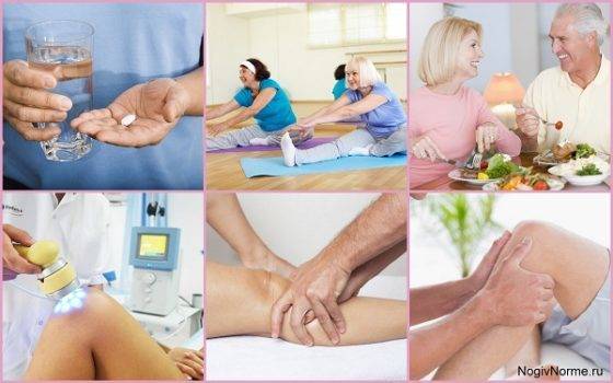 Гонартроз 2 степени коленного сустава - лечение медикаментозными и народными средствами, диетой и гимнастикой
