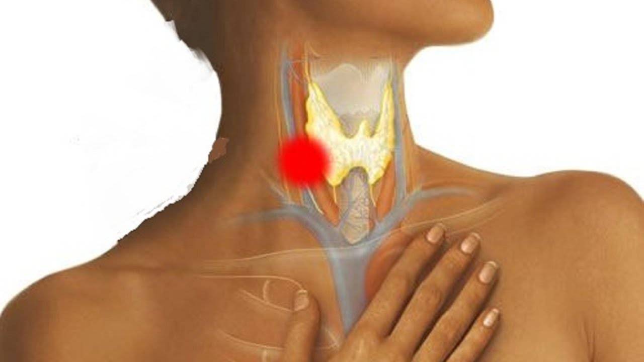Болит горло и больно глотать - причины и лечение