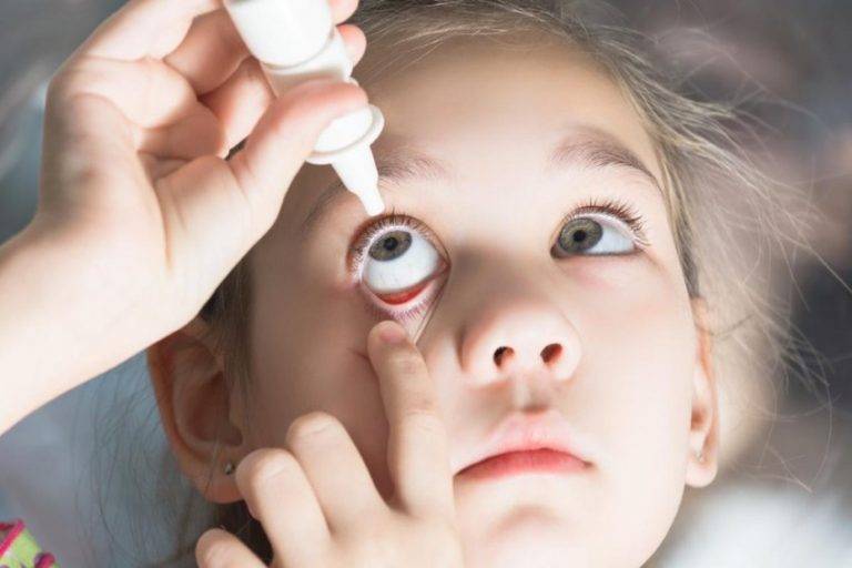 Вирусный конъюнктивит: симптомы и лечение у взрослых, препараты для глаз, медикаменты, как долго лечится