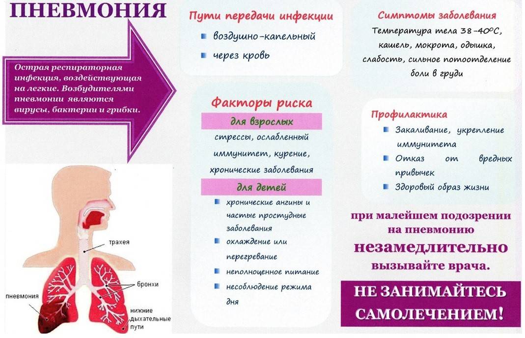 Пневмония: симптомы и признаки заболевания
