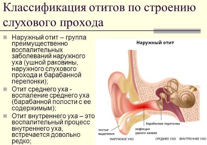 Отит среднего уха: симптомы и лечение у взрослых, антибиотики, хронический, острый, у детей