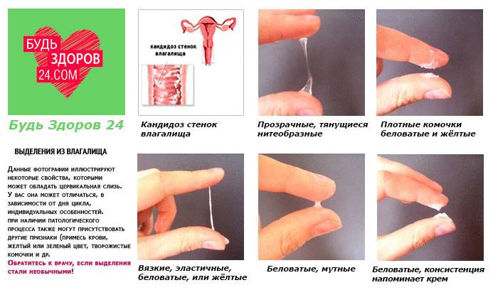 Гинекологические заболевания у женщин - список | гинекологи москвы