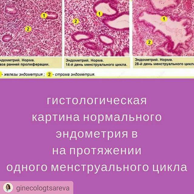 ᐉ гиперплазия эндометрия во время менопаузы лечение - sp-medic.ru