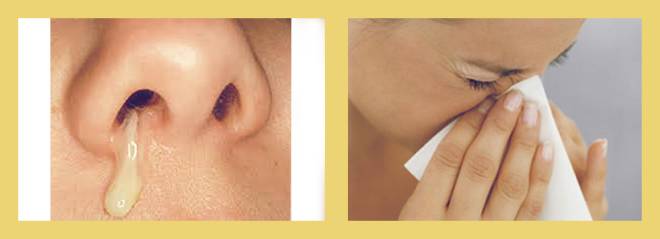 Отек носа без насморка: причины, симптомы и методы лечения