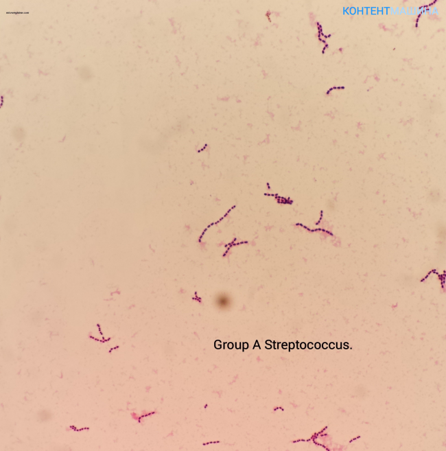 Бактерии вызывающие ангину относят к группе - грибок вирус ли это, стрептококк, микробы в горле