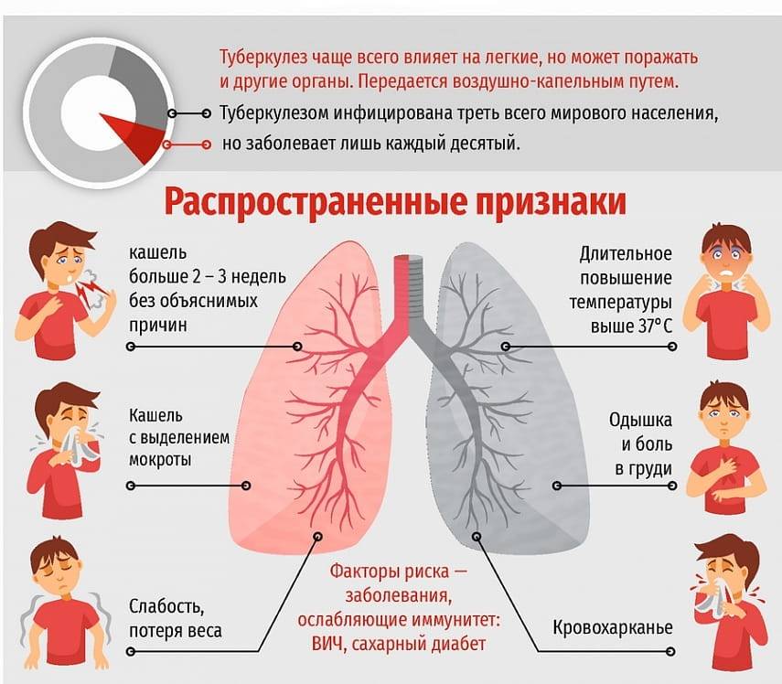 Туберкулез - симптомы, первые признаки, как передается у взрослых, как определить если с температурой, проявление, как начинается