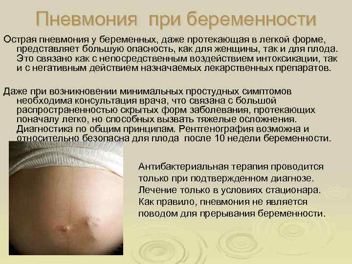 Влияние фарингита у беременной на ребенка