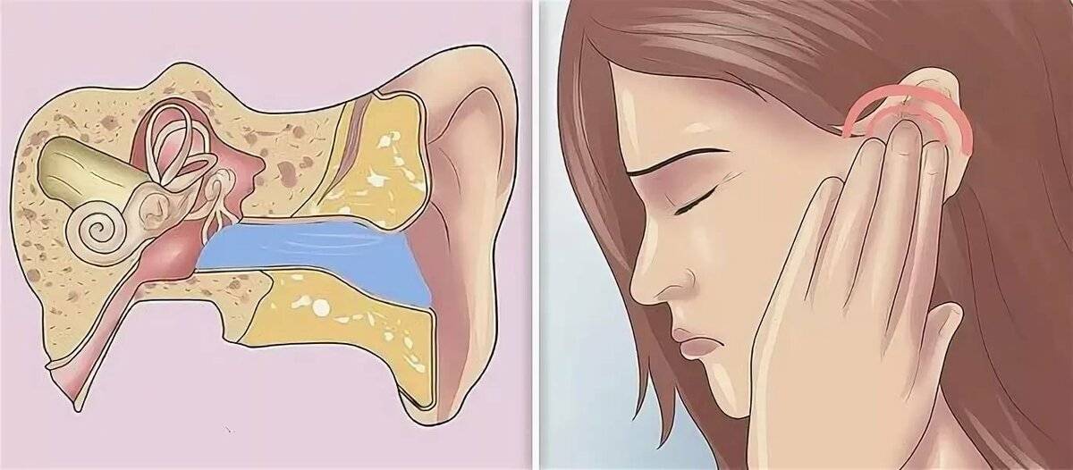 Заложено ухо после простуды - что делать и чем лечить в домашних условиях если заложило уши но не болит, заложенность и не слышит