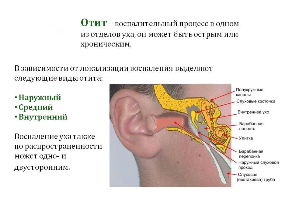 Отит наружного уха: острый, хронический, гнойный, диффузный | компетентно о здоровье на ilive