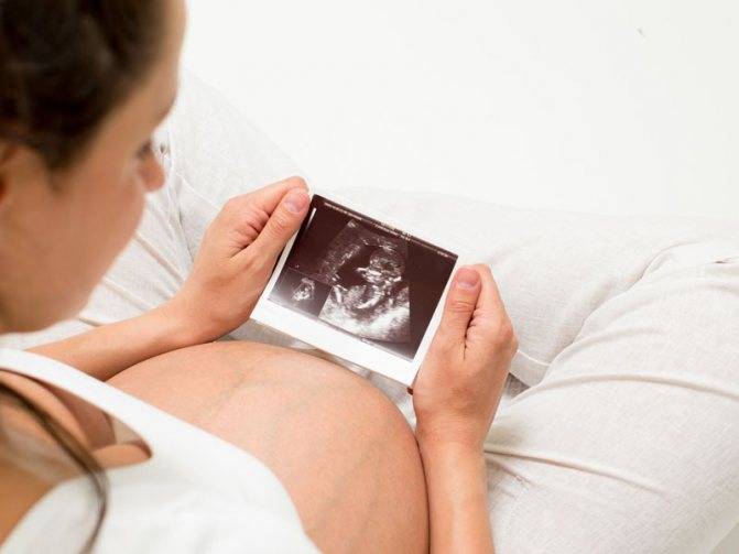 Внутриутробные инфекции при беременности и у новорожденных / mama66.ru