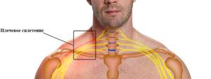 Методы лечения неврита плечевого нерва и его симптомы