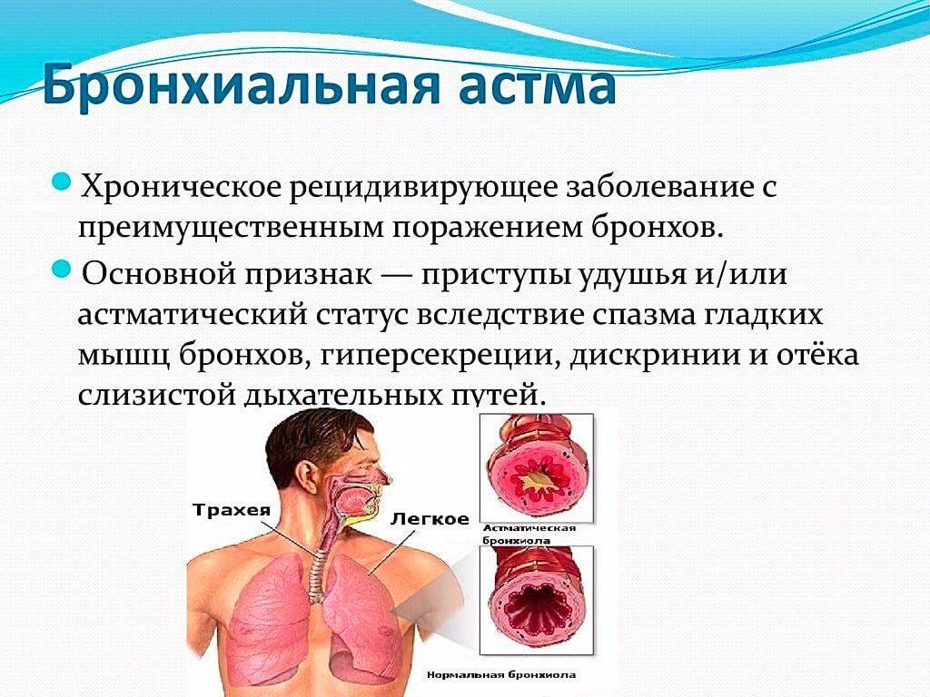 Симптомы и первые признаки бронхиальной астмы у детей, лечение и профилактика заболевания