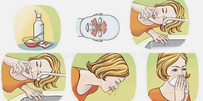 Заложило ухо при простуде: что делать и почему закладывает - причины и лечение во время болезни заложенности, из-за чего закладывает