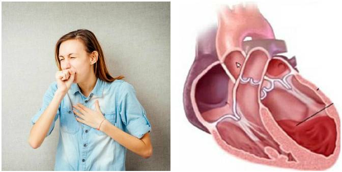 Причины возникновения кашля на фоне нарушения сердечной деятельности