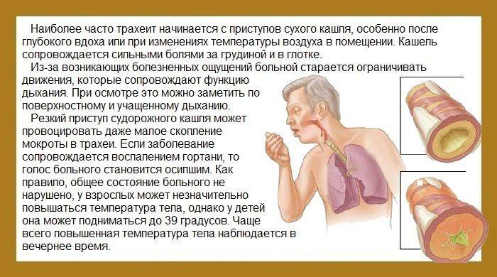 Приступообразный сухой кашель: как быстро снять приступ