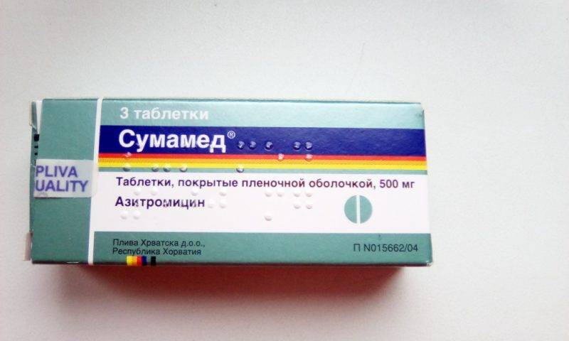 Гайморит - симптомы и лечение у взрослых в домашних условиях антибиотиками и народными средствами